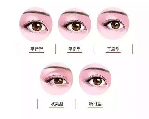 双眼皮手术成功的标准有哪些 上海美莱王琳 精细派美眼博士