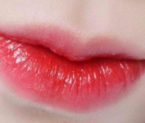 西安邵锦弘医生整形医院漂唇手术的优势 安全无痛长期有效