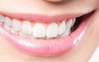 牙齿矫正反弹原因 西安优德口腔门诊部牙齿矫正优势