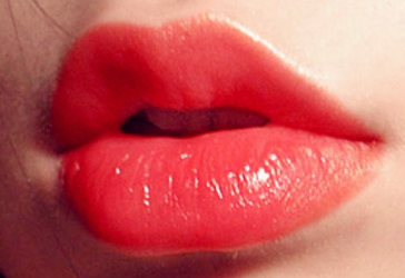 M唇和微笑唇是一样的么 深圳希思整形李瑞芳做M唇拆线疼吗