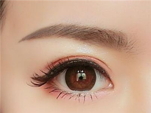 做双眼皮哪种更自然 成都华人医联高亮美杜莎电眼创始人