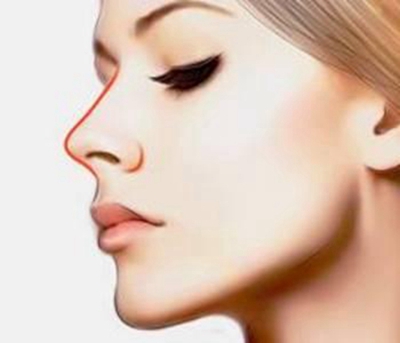 包头叶子整形张会堂鼻再造 个性设计 为您恢复缺损的鼻子