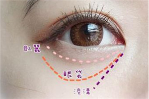南京哪个医院祛眼袋好 激光<font color=red>去眼袋</font>的价格是多少
