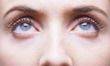 美眼不失色 遵义利美康整形吸脂祛眼袋有哪些优势 多久恢复