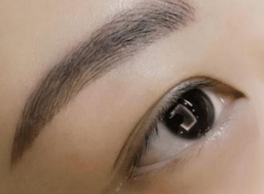 切眉手术有什么作用 普宁安琪整形重塑眉形 恢复眼部青春