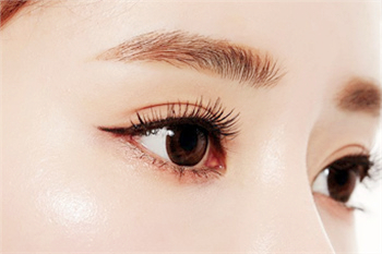 杭州时光哪个医生做双眼皮好 美眼专家范眉清双眼皮案例图