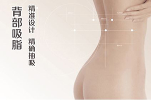 重庆美联臣专业抽脂医院 背部吸脂减肥 塑造性感背影