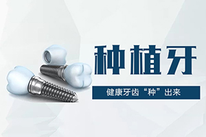 上海九院种植牙很有名 在线预约咨询 附种植牙价格表图