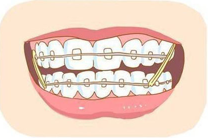 西安好的口腔医院推荐 中诺口腔牙齿矫正费用一般多少