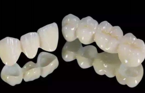 全瓷牙冠图片 贵阳牙博士口腔全瓷牙多少钱一颗 能用多久