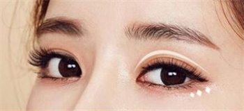 昆明悦格整形医院韩式双眼皮前后对比 韩式双眼皮价格表