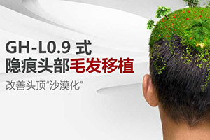 北京毛发移植 雍禾头发种植收费表 茂盛|自然