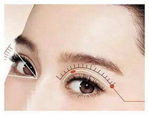 上海双眼皮修复医院哪家好 在东方丽人割双眼皮修复多少钱