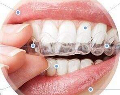 武汉牙科医院哪家好 隐形牙齿矫正多少钱 不做钢牙妹