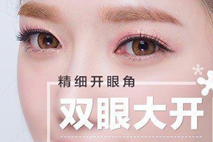 比较好的眼部整形医院 上海首尔丽格正规 开眼角效果图