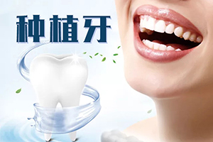 广州口腔医院哪个好 美莱医疗连锁品牌 含种植牙价格