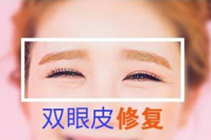 北京双眼皮修复推荐医院 北京华悦府专业眼部整形 收费合理