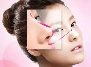 衡阳鼻整形专家推荐 华美整形刘文医生垫鼻尖 立体感提升