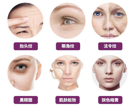 脸上皱纹很多怎么办 郑州艺龄整形医院射频除皱逆龄紧肤