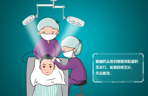 杭州首瑞医院毛发种植效果图 头发种植多少钱