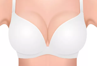 长沙胸部整形 赫美整形做乳房下垂矫正特点 恢复快吗 