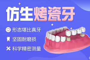 成都仁齿口腔医院烤瓷牙效果怎么样 能保持多少年
