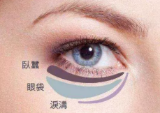 广州禧萃医疗整形诊所外切祛眼袋过程 解决老态形象
